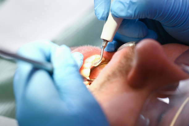 Best Emergency TMJ Treatment in Franconia, VA
