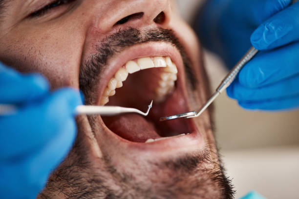 Best Emergency Treatment for Dental Infections or Abscesses in Franconia, VA