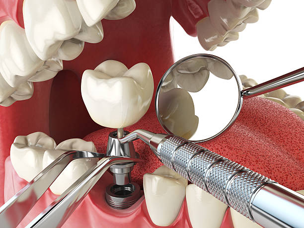 Franconia, VA Emergency Dentist Pros